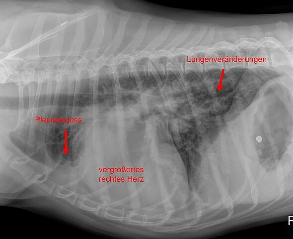 Abbildung 12: Rechtsherzversagen als Folge einer Herzwurmerkrankung bei einem Hund mit fortgeschrittenem Befall. In der seitlichen Röntgenaufnahme des Brustkorbes fällt ein deutlich vergrößertes rechtes Herz auf. Neben deutlichen Lungenveränderungen kann eine leichte Wassereinlagerung im Brustkorb (Pleuraerguss) dargestellt werden.