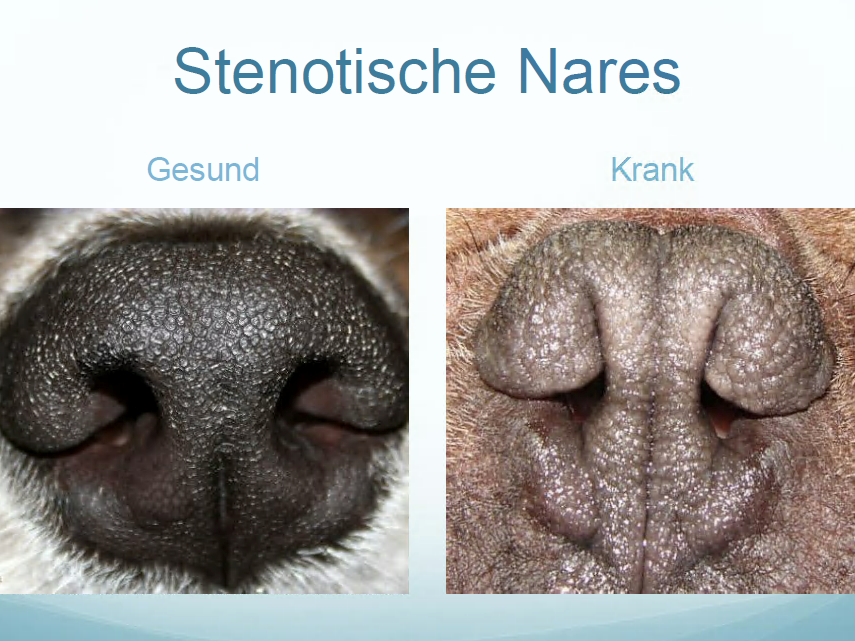 Links: normal ausgebildete Nasenflügel. Rechts: die stark verdickten Nasenflügel behindern den Luftstrom.
