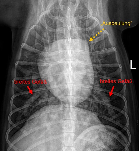 Abbildung 6: Ventrodorsale Aufnahme (auf dem Rücken-liegend) des gleichen Hundes: es fallen deutlich verbreiterte Lungengefäße auf (rot). Auf „2 Uhr“ wird eine Ausbeulung im Bereich des Herzen deutlich (gelb). Diese stellt die verbreiterte herznahe Lungenarterie (Hauptpulmonalarterie) dar.  