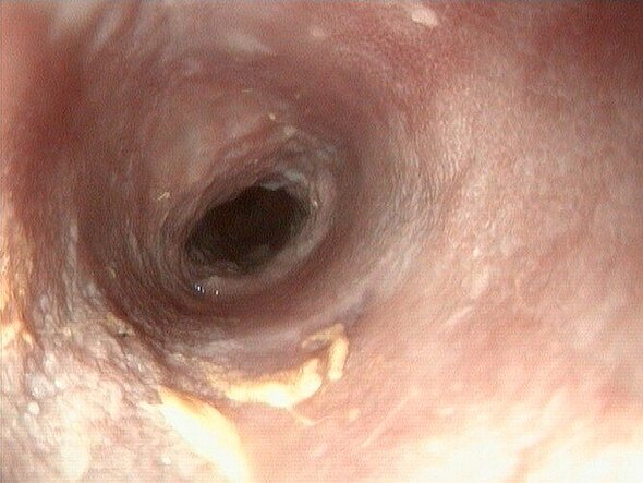 Dieses Endoskopbild zeigt das Innere des Dünndarms eines Hundes. Es sind gelbliche Auflagerungen zu erkennen, die Schleimhaut glänzt nicht. Es liegt eine chronische Darmerkrankung vor.