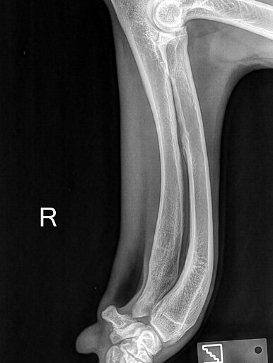 Carpus Valgus/Radius Curvus prä OP
