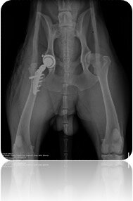 Post OP: Einsatz einer Hüftgelenks-Totalendoprothese