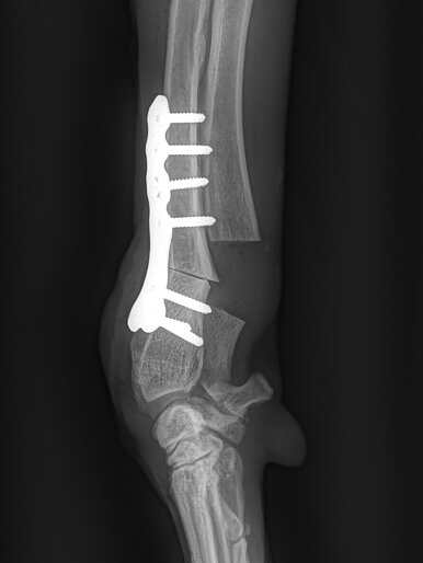 Carpus Valgus/Radius Curvus post OP