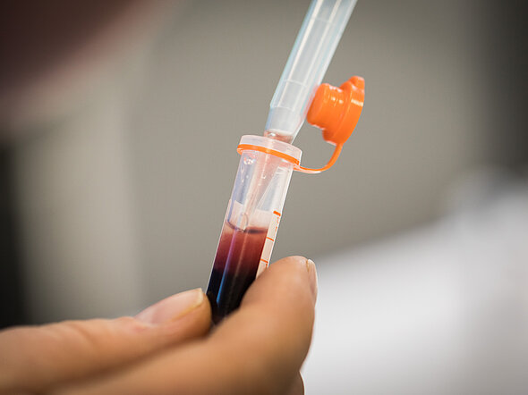 Hier wird aus einem Blutröhrchen das abzentrifugierte Plasma mit einer Pipette abgezogen.