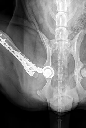 Zustand nach Totalendoprothese des Hüftgelenkes (TEP)