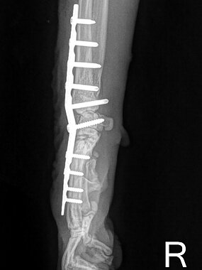 Pancarpalarthrodese rechts