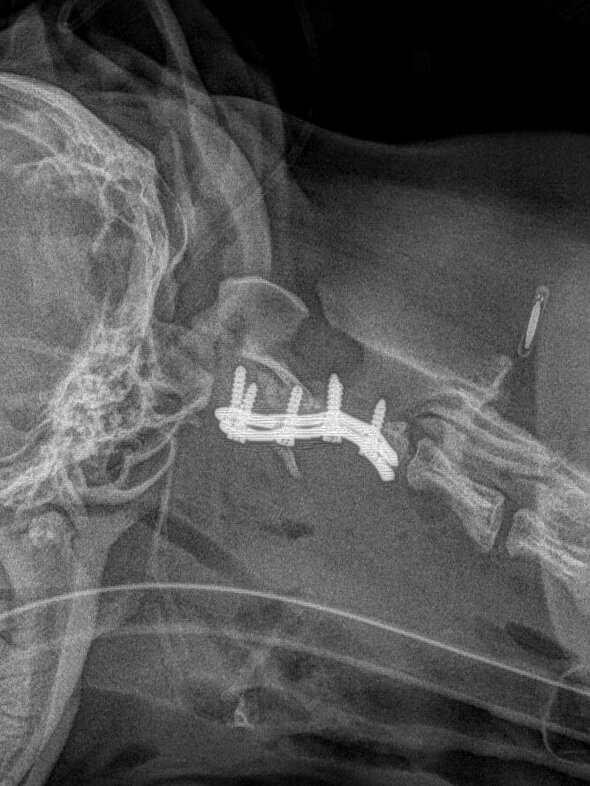 Atlantoaxiale Instabilität Hund, post OP
