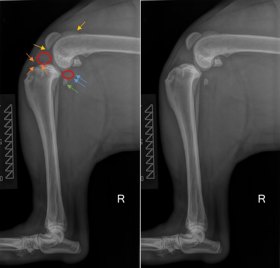 Kreuzbandriss Gelbe Pfeile: osteophytäre Ausziehungen Orangene Pfeile: Verdrängung des infrapatellaren Fettkörpers nach cranial und distal aufgrund des mittelgradigen Gelenkergusses (rot markiert) Blaue Pfeile: Verdrängung der Faszie nach caudal aufgr Kreuzbandriss Gelbe Pfeile: osteophytäre Ausziehungen Orangene Pfeile: Verdrängung des infrapatellaren Fettkörpers nach cranial und distal aufgrund des mittelgradigen Gelenkergusses (rot markiert) Blaue Pfeile: Verdrängung der Faszie nach caudal aufgrund des mittelgradigen Gelenkergusses (rot markiert) Grüner Pfeil: distale Dislokation des poplitealen Sesambeins Tibia in cranialer Subluxationsstellung
