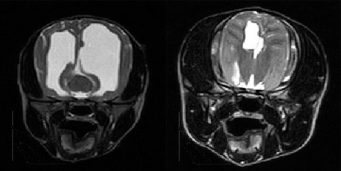 Hydrocephalus eines Yorkshire-Terrier Welpens (16 Wochen alt) vor (links) und 12 Monate nach (rechts) Implantation eines ventriculo-peritonealen Shunts. Die im Gehirn angestaute Flüssigkeit (weiß) nimmt deutlich weniger Raum ein. Das Hirngewebe hat sich gut entwickelt.
