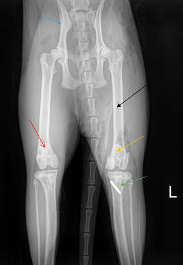 Chirurgische Versorgung der Patellaluxation: Blau: knöchernes Becken; Schwarz: Oberschenkelknochen (Femur); Gelb: nach OP Patella in physiologischer Position; Grün: Implantat zur Versetzung des Sehnenansatzes am knöchernen Unterschenkel; Rot: Patella in ihrer physiologischen Position